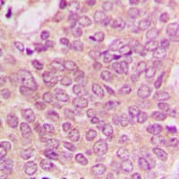 Polyclonal Rabbit anti-Human PEA15 / PEA-15 Antibody (Internal, IHC, WB)