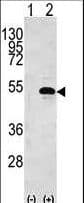 Polyclonal Rabbit anti-Human CKB / Creatine Kinase BB Antibody (aa1-30, WB)