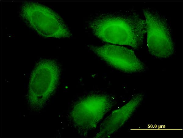 SARS / Serine-tRNA Ligase Antibody (clone 1H4)
