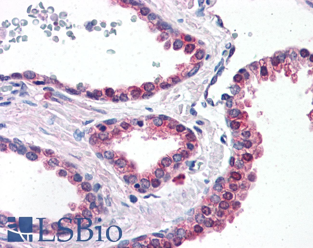 IHC-plus™ Polyclonal Rabbit anti-Human LOXL2 Antibody (Internal, IHC)