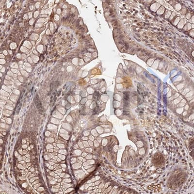 COL1A2 / Collagen I Alpha 2 Antibody