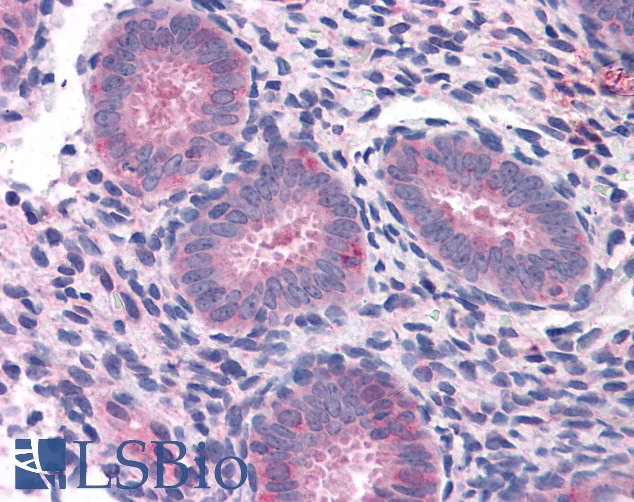 IHC-plus™ ELP3 Antibody