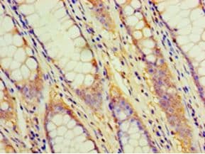 CD2 Antibody (aa25-209, Biotin)