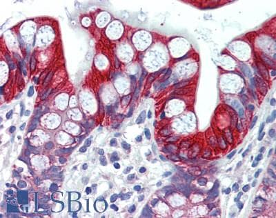 IHC-plus™ SLC16A7 / MCT2 Antibody