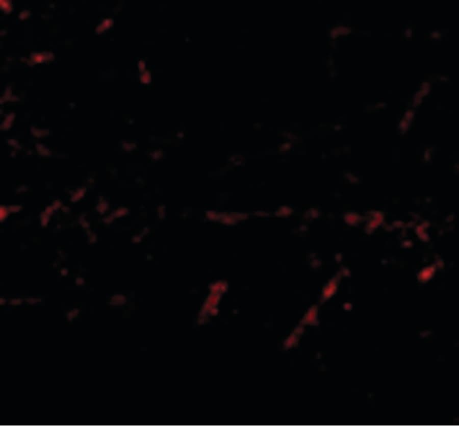 Polyclonal Rabbit anti-Human LGI1 Antibody (IHC, IF, WB)