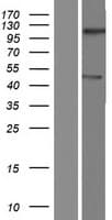 TMEM194B Protein (Over-Expression Lysate Myc-DDK (Flag))