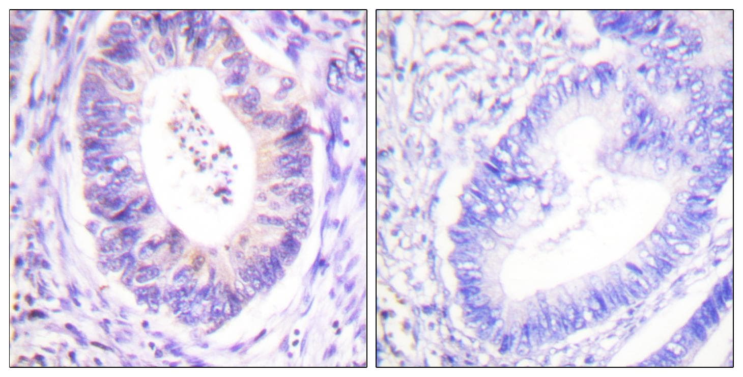 RPS6KA1 / RSK1 Antibody (p573)