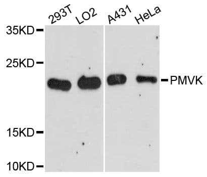 Polyclonal Rabbit anti-Human PMVK Antibody (WB)