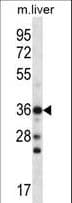 CBX8 Antibody (aa161-189)