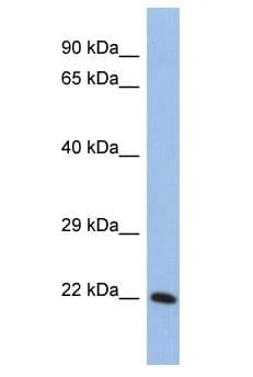 SMPD1 / Acid Sphingomyelinase Antibody (aa79-128)
