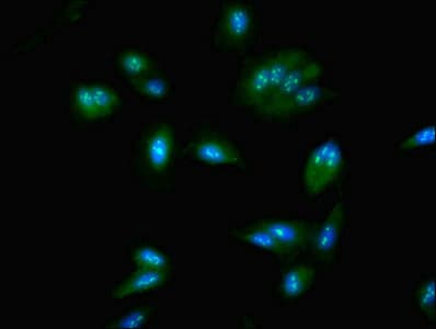 Polyclonal Rabbit anti-Human NOP58 / NOP5 Antibody (WB)