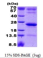 Human JCHAIN / Ig J Chain Protein (Recombinant His)