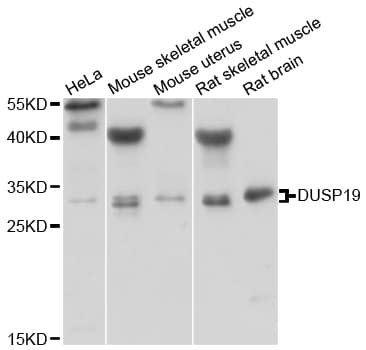 DUSP19 / SKRP1 Antibody