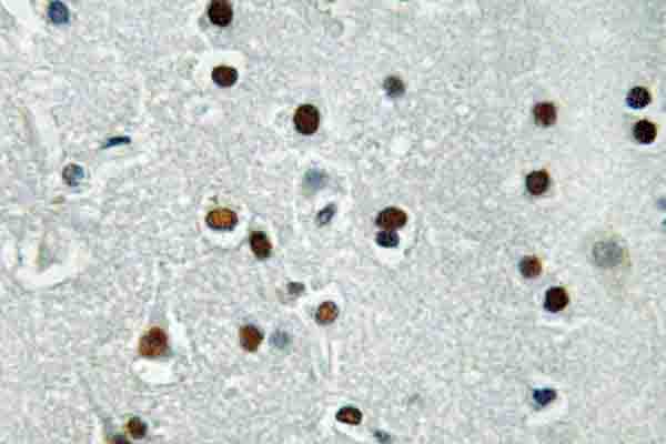 ASCL1 / MASH1 Antibody (Glu158)