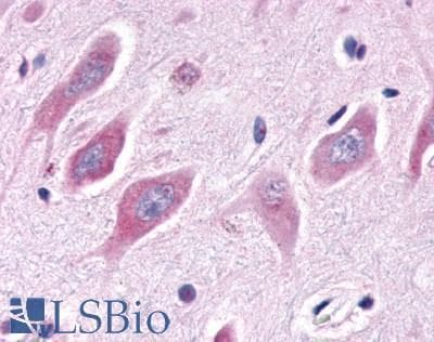 PathPlus™ ESRRA / ERR Alpha Antibody (Internal)