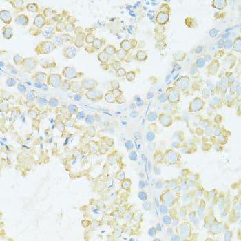 MYH10 Antibody