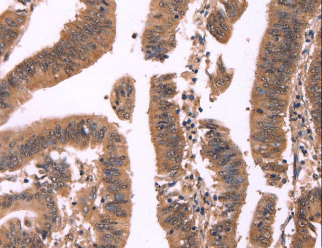 FBXO31 Antibody