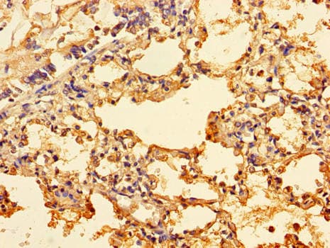 Polyclonal Rabbit anti-Human ING3 Antibody (IHC, WB)
