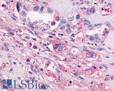 PathPlus™ GPR55 Antibody (C-Terminus)