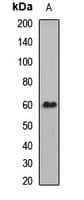 UGT1A / UGT1A1 Antibody