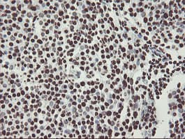 NONO / P54NRB Antibody (aa184-385, clone OTI5F1)