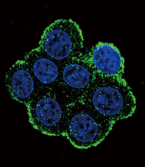 ALK3 / BMPR1A Antibody (aa21-51)