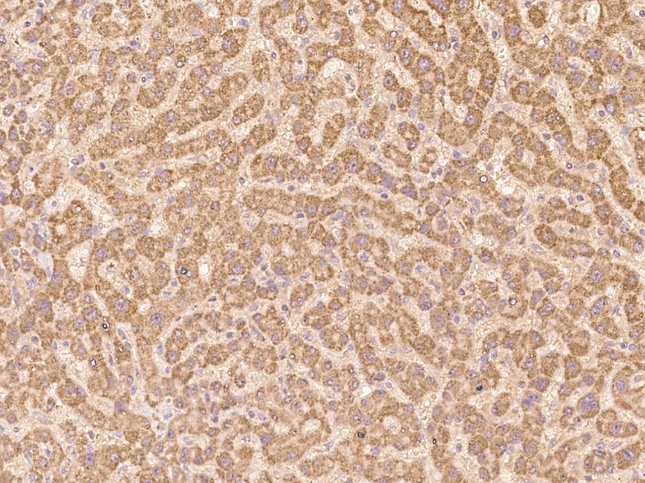 Polyclonal Rabbit anti-Human CLRN2 Antibody (IHC)