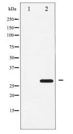 Polyclonal Rabbit anti-Human ATF1 Antibody (IHC, WB)