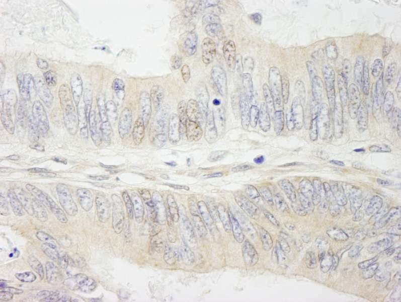 Polyclonal Rabbit anti-Human MYBBP1A Antibody (aa450-500, IHC)