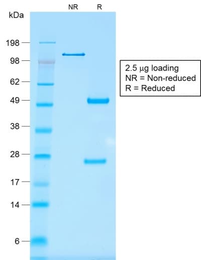 Recombinant Monoclonal Mouse anti-Human EPCAM Antibody (clone rMOC-31, IHC)