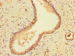 Polyclonal Rabbit anti-Human DSTN / Destrin Antibody