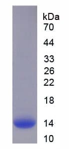 Human CGB1 Protein (Recombinant His-T7)