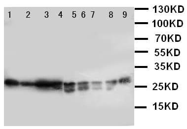 PRDX3 / Peroxiredoxin 3 Antibody (aa240-257)