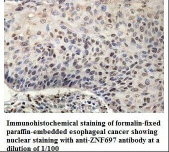 ZNF697 Antibody (aa1-136)