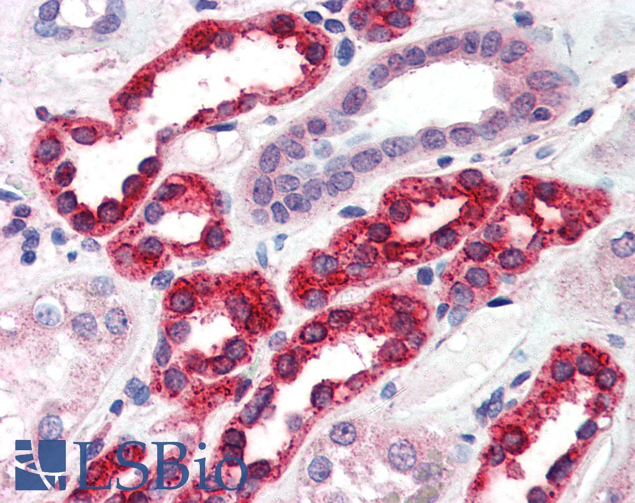 IHC-plus™ GGA3 Antibody (aa702-713)