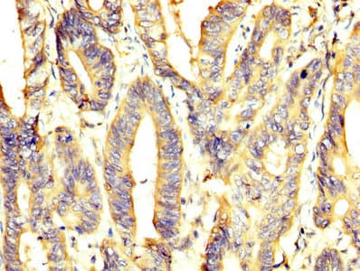 PKM / Pyruvate Kinase, Muscle Antibody