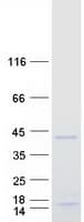 Human PRX-1 / PRRX1 Protein (Recombinant Myc-DDK (Flag))