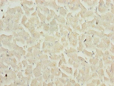 Polyclonal Rabbit anti-Human TIMP1 Antibody (IHC, WB)