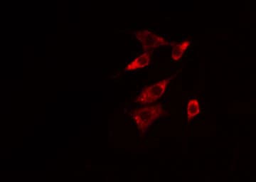 NTSR1 / NTR Antibody