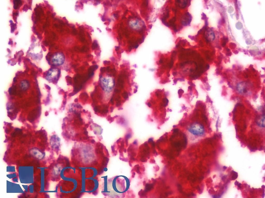 IHC-plus™ KCNMB4 Antibody (aa70-119)