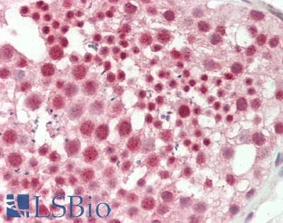 TSC22D1 / TSC22 Antibody (aa35-84)