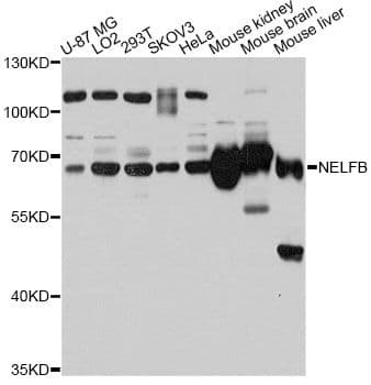 Polyclonal Rabbit anti-Human NELFB / COBRA1 Antibody (WB)