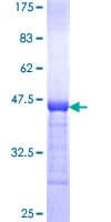Human GGCX Protein (Recombinant GST, N-terminus)