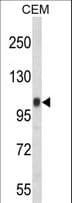Polyclonal Rabbit anti-Human ITGB3 / Integrin Beta 3 / CD61 Antibody (aa734-760, IHC, WB)