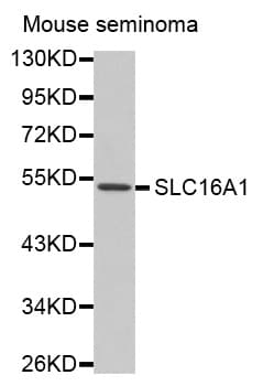 IHC-plus™ SLC16A1 / MCT1 Antibody