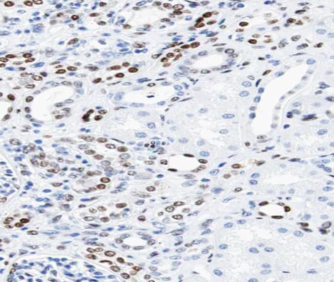 KAT2B / PCAF Antibody