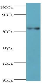 PNPLA3 / Adiponutrin Antibody (aa377-481)