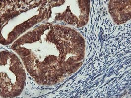 COASY Antibody (clone OTI3B3)