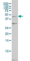 PSMC2 / RPT1 Antibody (clone 4C10-2C8)