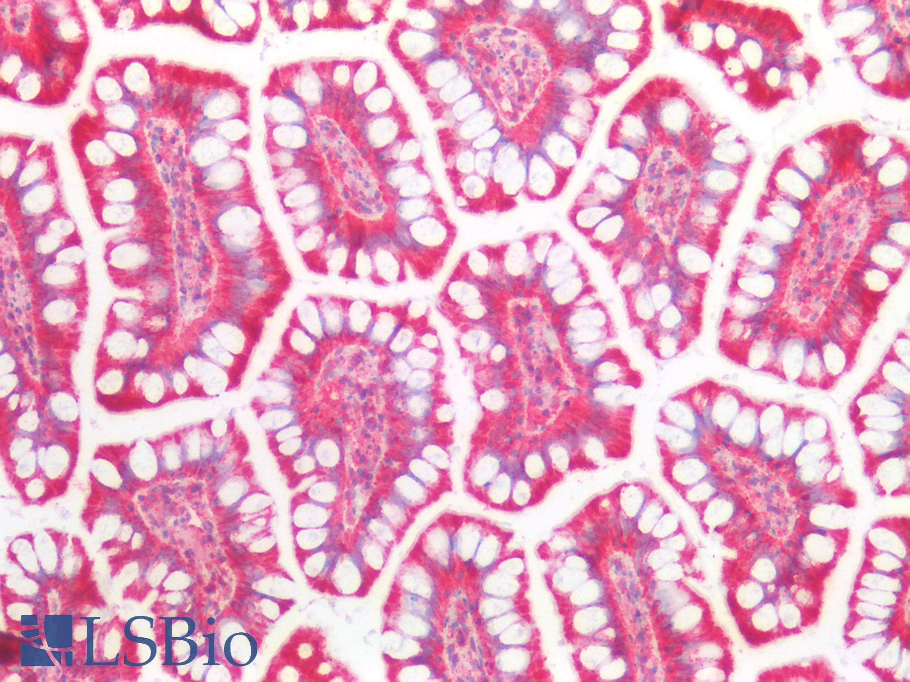 PathPlus™ SLC9A3R1 / NHERF1 / EBP50 Antibody (N-Terminus)